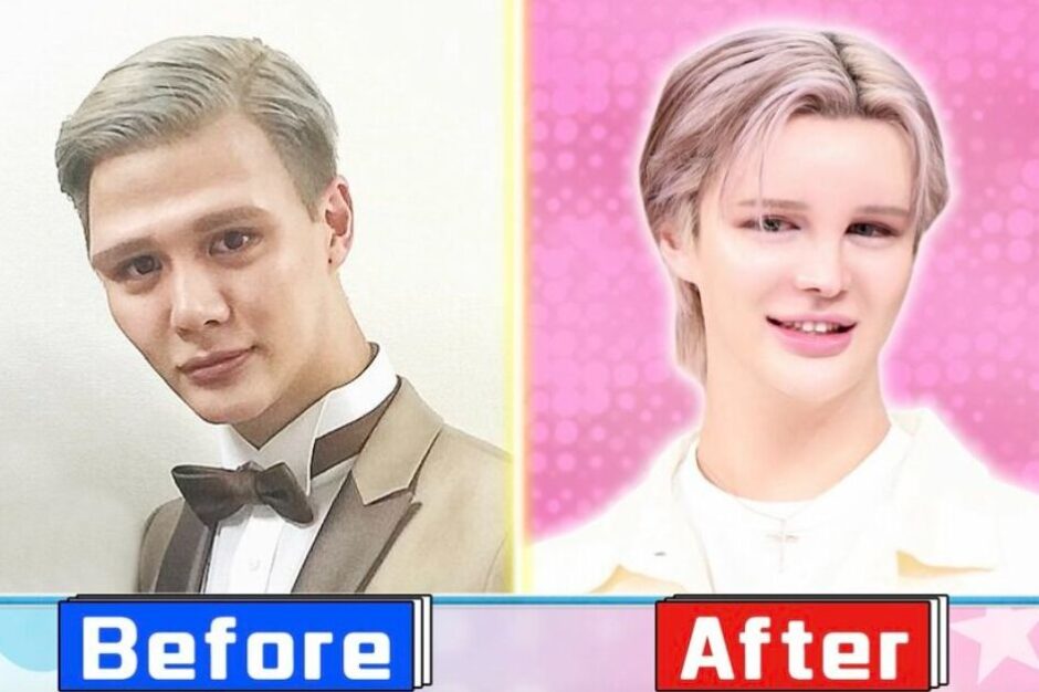 Matt整形前の元の顔と現在を比較!昔と今の顔が激変…総額1000万&-16kg | おじトピ