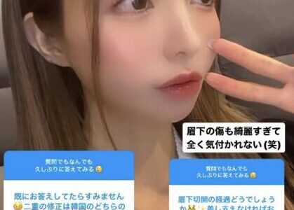 一条響は整形前の昔と顔変わった！豊胸の噂も画像を比較し検証！