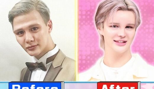 Matt(マット)整形前の元の顔から激変！昔からの顔の変化を比較！
