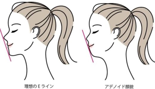 アデノイド顔貌で顎がないと噂の男性や女性の芸能人まとめ